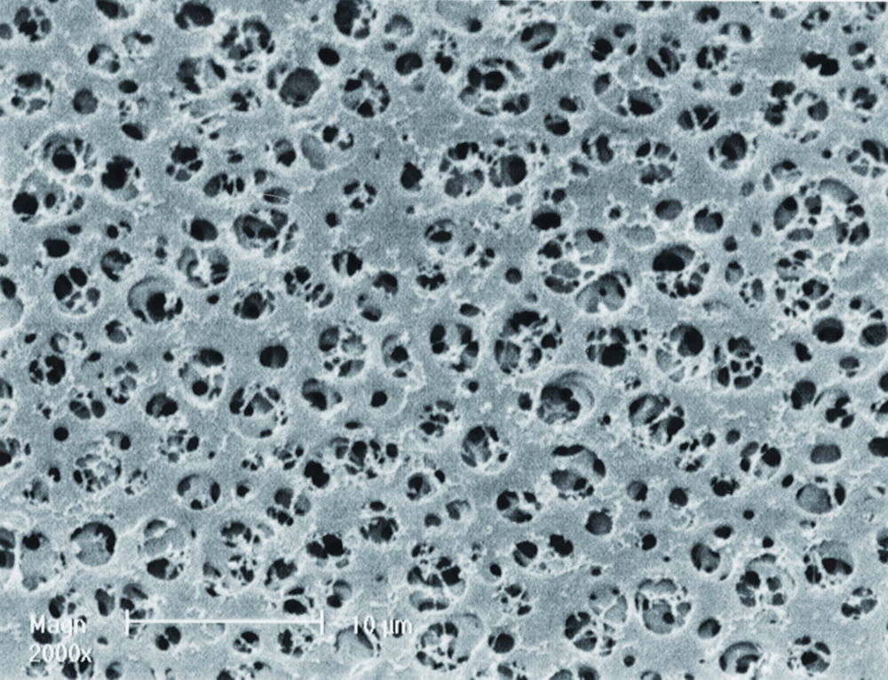 GEL blotting paper